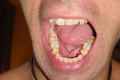Як називаються зуби?