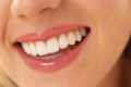 Як відбілити зуби перекисом?