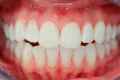Скільки зубів у людини?
