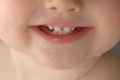 Скільки зубів у рік?
