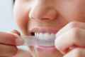 Чи шкідливо відбілювання зубів?